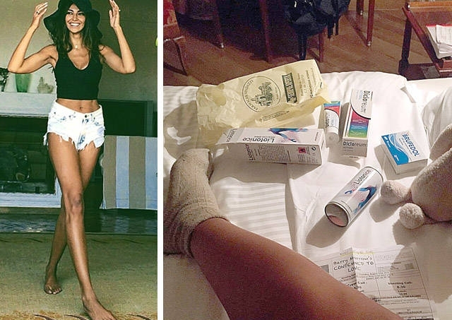 Mădălina Ghenea s-a accidentat pe platourile de filmare 2 piciorentorsa.jpg