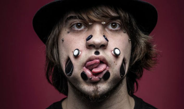 ŞOCANT. Şi-a făcut GĂURI în faţă! 3 Miggler2_195615.jpg