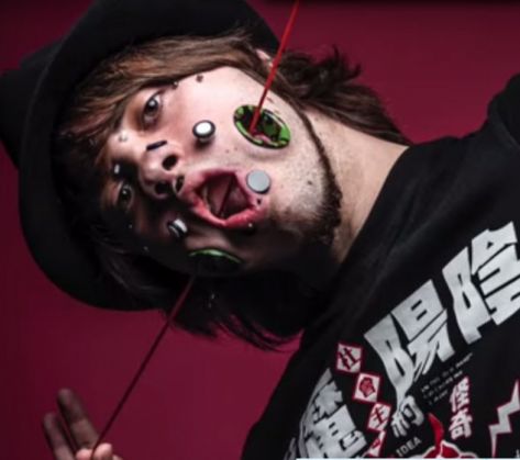 ŞOCANT. Şi-a făcut GĂURI în faţă! 2 miggler4_195614.jpg