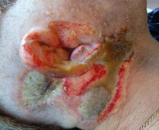 BRAȘOV. Mutilat de artificii! Atenție! Imagini care vă pot afecta emoțional 4 mutilat de artificii1_201663.jpg