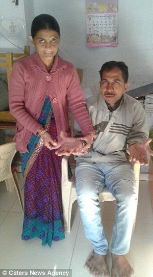 Are 28 de degete la mâini şi la picioare 2 28degete1.jpg