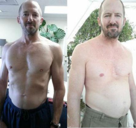 A băut 10 cutii de Cola pe zi! Uite ce i s-a întâmplat, după o lună… 4 zahar4_202646.jpg