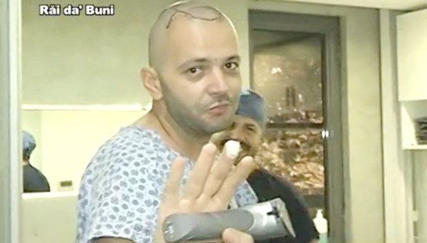 Mihai Morar a suferit o intervenţie estetică 2 morar_2.jpg