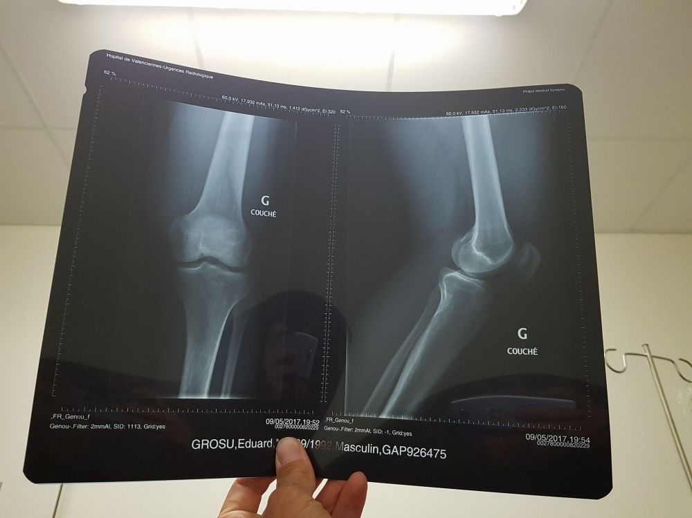 Ciclistul brașovean Eduard Grosu - ACCIDENTARE GRAVĂ!!! 2 grosu_7.jpg