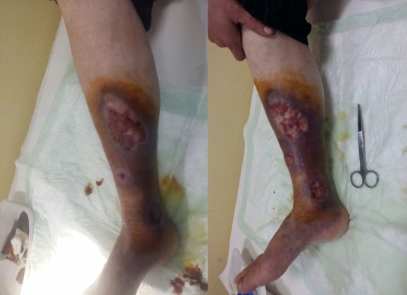 poze picior_238806.jpg