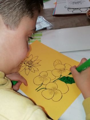 sarb-sindrom-Down3 (1)_264750.jpg