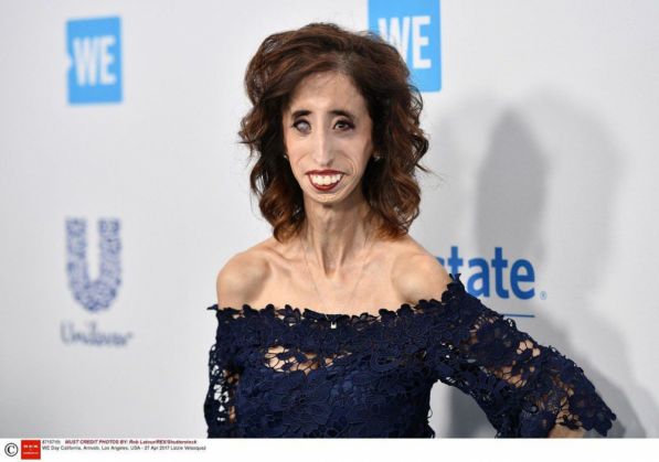 A depăşit durerea provocată de titlul de „cea mai urâtă femeie din lume” şi are o carieră de invidiat 2 femeie 2_268532.jpg