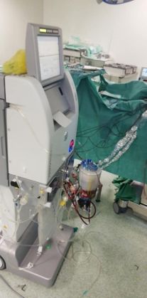 spital-operatie-sarcom3_268872.jpg