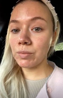 Și-a distrus tenul cu tratamente de... înfrumusețare / Cum a ajuns să arate una dintre cele mai cunoscute dansatoare din România (Galerie FOTO) 3 dansatoare 2_284403.jpg