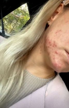 Și-a distrus tenul cu tratamente de... înfrumusețare / Cum a ajuns să arate una dintre cele mai cunoscute dansatoare din România (Galerie FOTO) 2 dansatoare 3_284404.jpg