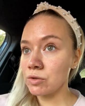 Și-a distrus tenul cu tratamente de... înfrumusețare / Cum a ajuns să arate una dintre cele mai cunoscute dansatoare din România (Galerie FOTO) 4 dansatoare_284405.jpg