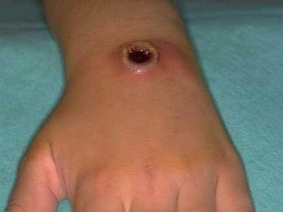A început campania de vaccinare împotriva antraxului 1 article_433867_1.jpg