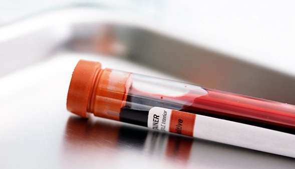 ÎNGRIJORĂTOR. O bacterie rezistentă la toate antibioticele, descoperită la un pacient, în Danemarca 1 sangeproba.jpg