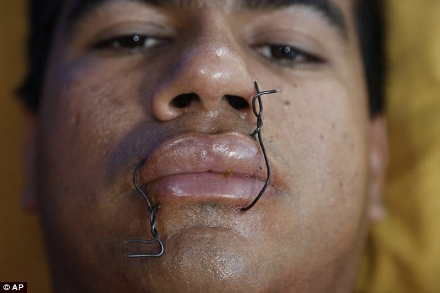 PROTEST EXTREM. Legați cu sârmă la gură și crucificați!!! 1 paraguay.jpg