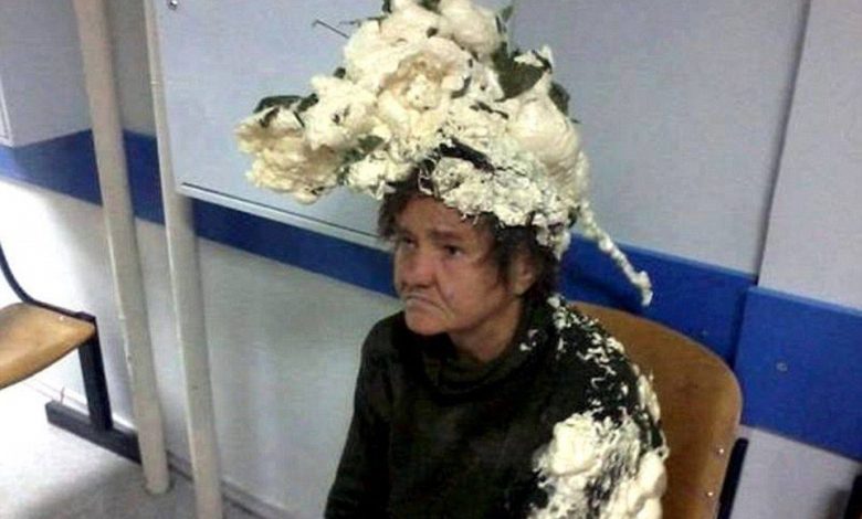 A ajuns la spital după ce a crezut că îşi face coafura cu spumă de păr… 1 spumadepar.jpg