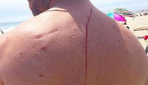 INCREDIBIL. Rechinul care l-a atacat i-a salvat viața!!! 1 rechin_2.jpg