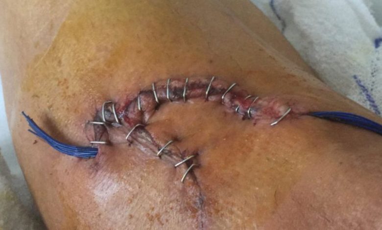 Accidentare HORROR!!! Produsă de... 1 accidentare.jpg