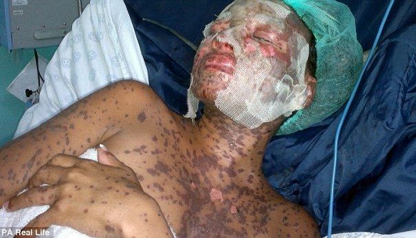 La un pas de moarte din cauza antidepresivelor (FOTO) 1 antidepresive_2.jpg