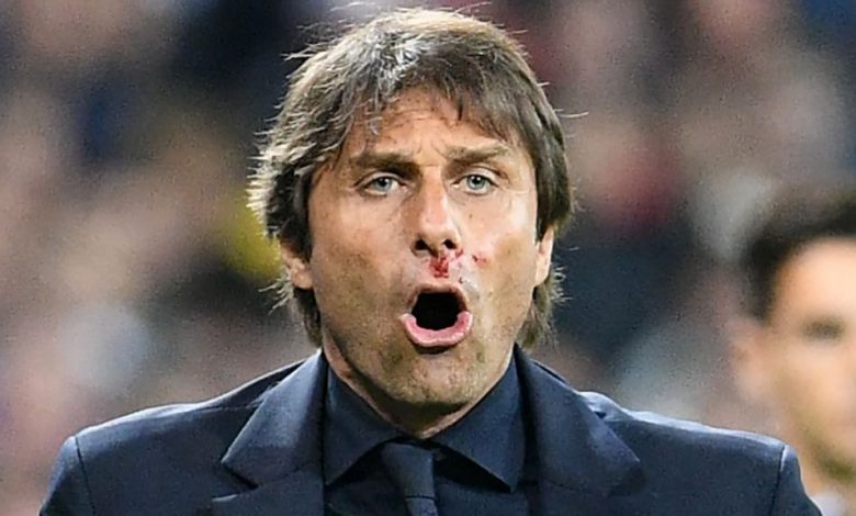 EURO 2016. Selecţionerul Italiei, cu sânge pe faţă 1 contesange.jpg