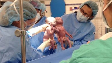 identical-twins-born-holding-hands-jenna-jillian-sarah-thist
