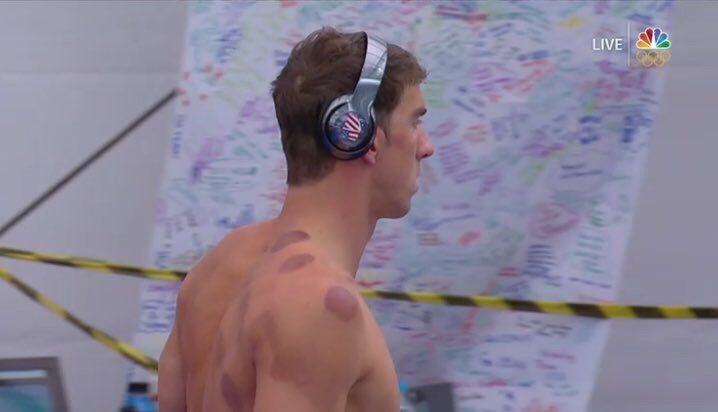 JO RIO 2016. Americanii apelează la... VENTUZE (FOTO) 1 phelpsventuze.jpg