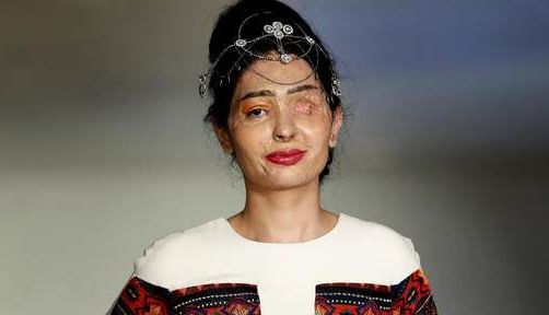 DESFIGURATĂ cu acid, a participat la Fashion Week!!! 1 desfigurat.jpg