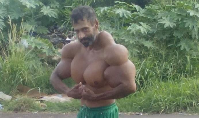 Și-a INJECTAT ulei în mușchi pentru a arăta ca Schwarzenegger!!! 1 segato.jpg