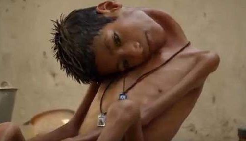 DUPĂ 13 ANI DE CHIN. Poate avea o viață normală!!! 1 viata.jpg