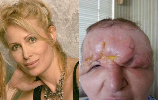 ŞOCANT. Chirurgia estetică poate fi UN COŞMAR!!! 1 chirurgieestetica.jpg