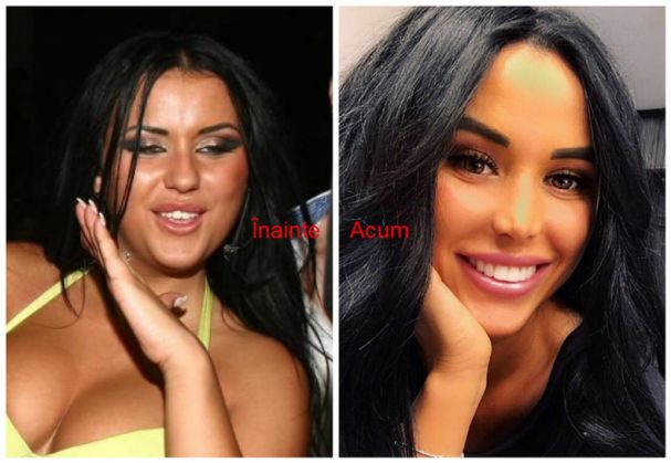 Wow!Cum arată Daniela Crudu după nenumăratele operaţii estetice făcute în ultima vreme ! 1 daniela crudu3_234898.jpg