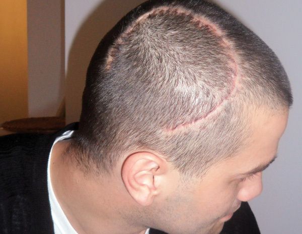 Chivu, PROBLEME MARI cu degetele mâinii stângi!!! 1 chivu_11.jpg