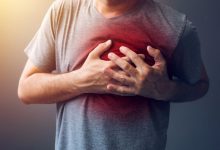 Infarctul de la 50 de ani poate începe cu 25 de ani mai devreme. Dr. Mihail Pautov explică de ce 10 infarct-miocardic_252745.jpg