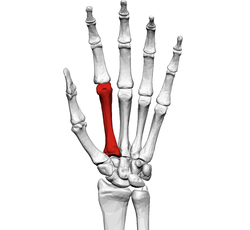 Cât e de gravă accidentarea Sorinei Târcă. Explicații medicale 1 metacarpian2.png