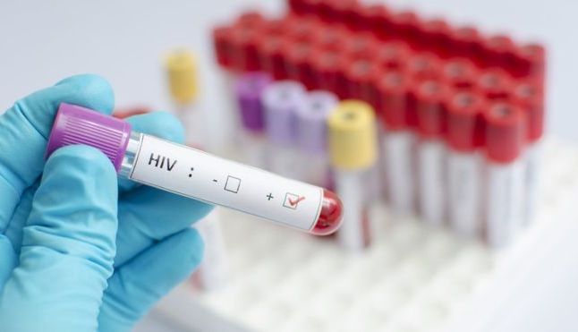hiv_2.jpg