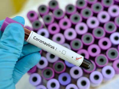 Update CORONAVIRUS BRAȘOV. Patru cazuri confirmate! Două sunt din județul Covasna 1 covid-19.jpg