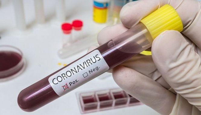 CORONAVIRUS BRAȘOV. Situația la zi! Peste 2.500 de persoane autoizolate, aproape 100 carantinate 1 cov4.jpeg