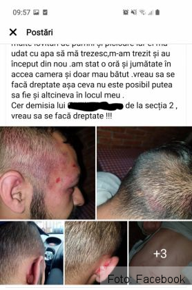 Un brașovean ce ar fi cunoscut pentru comportament violent se plânge că a fost bătut de polițiști 1 20200524_124806_280774.jpg