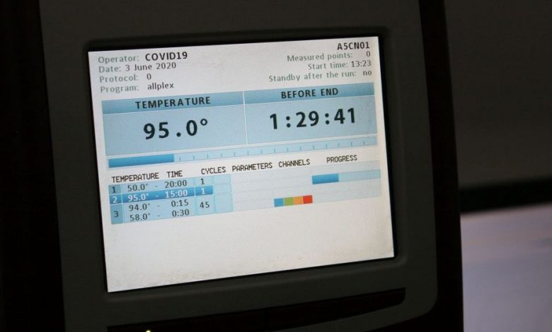 Update BRAȘOV. Şi managerul Spitalului Judeţean a fost testat pozitiv la coronavirus 1 analiza-covid.jpg