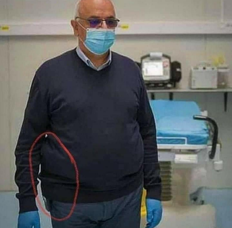 Raed Arafat, despre „PISTOLUL” pe care-l poartă la brâu... 1 arafat_4.png