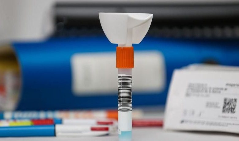 CORONAVIRUS BRAȘOV. Elevii vor fi testați de joi. Dar tot nu se știe procedura 1 testesaliva1.jpg