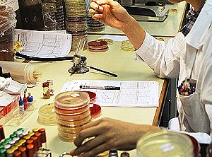 6,5 kilograme de mercur, descoperite într-un cabinet stomatologic la Slobozia 5 | MyTex.ro