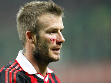 „Becks” se va reface la Los Angeles 5 | MyTex.ro