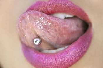 A murit din cauza unui piercing în limbă 5 | MyTex.ro