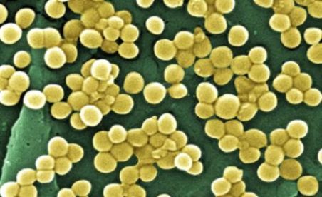 Antibioticele ar putea deveni inutile 5 | MyTex.ro