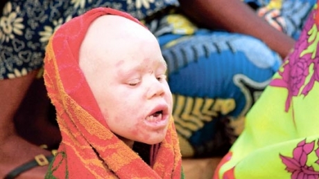 Fetiță decapitată de vrăjitori în Africa 5 | MyTex.ro