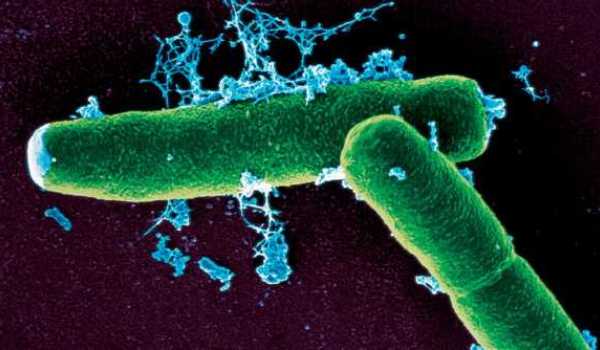 Infecție cu antrax în Bulgaria 5 | MyTex.ro