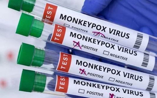 Primul caz de variola maimuței diagnosticat în România 5 | MyTex.ro