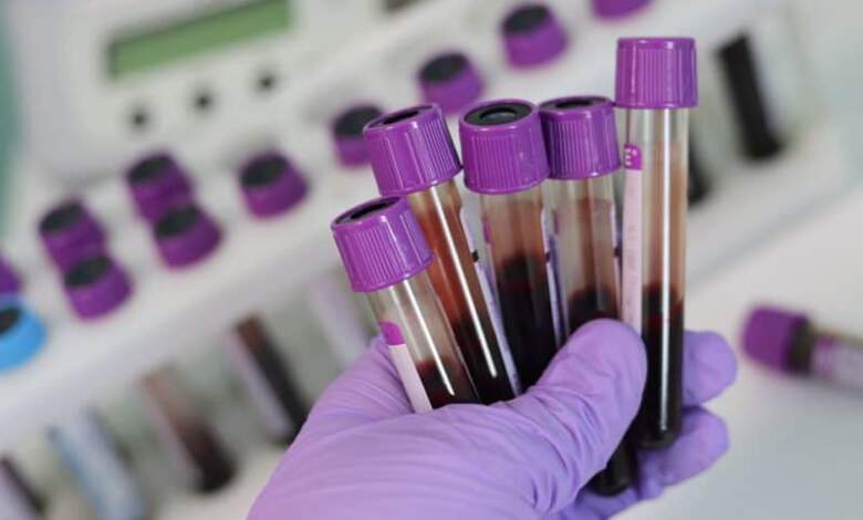 Lista și prețul analizelor care se pot face în laboratorul de toxicologie al DSP Brașov 3 Lista | MyTex.ro