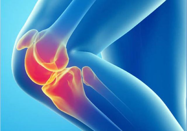 Patru alimente care distrug densitatea osoasă | MyTex.ro