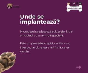 Microcipul | MyTex.ro